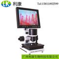 高清X(qián)W880微循環(huán)檢測儀 末梢血管觀(guān)察儀